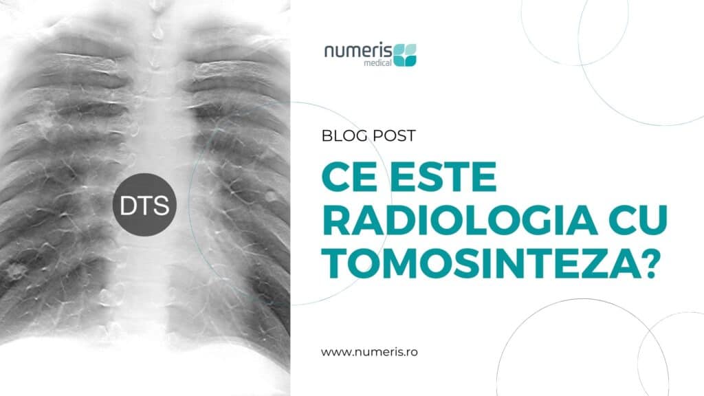 Ce este radiologia cu tomosinteza?