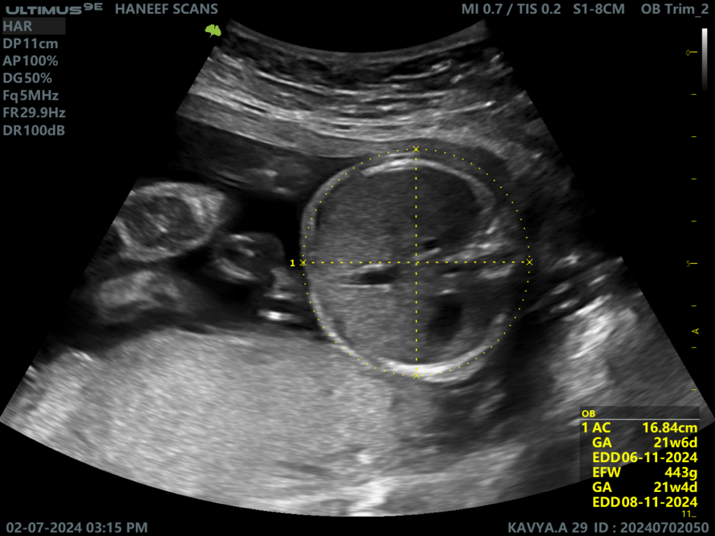 Ecograf VINNO Ultimus 9E – Precizie avansata in obstetrica-ginecologie