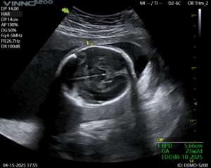 Ce urmeaza sa lanseze VINNO și Numeris Medical?