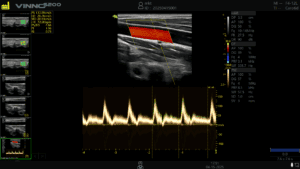 Ce urmeaza sa lanseze VINNO și Numeris Medical?