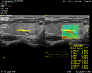 Ce urmeaza sa lanseze VINNO și Numeris Medical?
