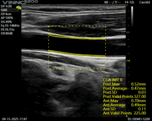 Ce urmeaza sa lanseze VINNO și Numeris Medical?
