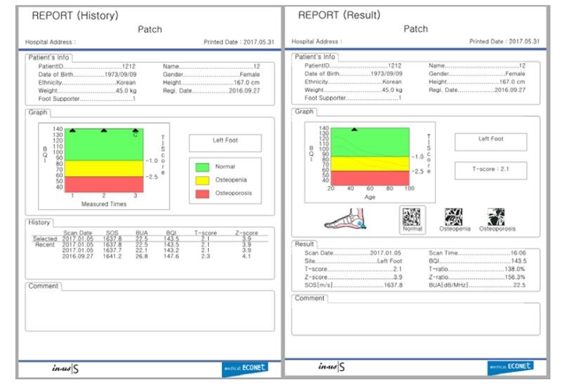 Ecografe portabile si ultraportabile | Numeris Medical
