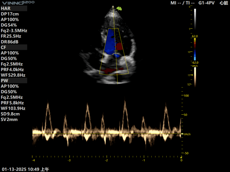 ecografe performante ecograf stationar ecograf portabil ecograf cu inteligenta artificiala aparatura medicala moderna echipamente medicale Romania furnizor echipamente medicale magazin aparatura medicala online aparatura pentru clinici medicale dotari cabinete medicale