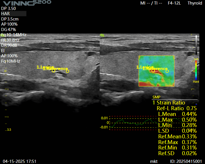 ecografe performante ecograf stationar ecograf portabil ecograf cu inteligenta artificiala aparatura medicala moderna echipamente medicale Romania furnizor echipamente medicale magazin aparatura medicala online aparatura pentru clinici medicale dotari cabinete medicale