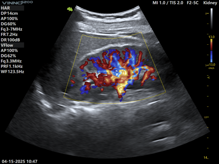ecografe performante ecograf stationar ecograf portabil ecograf cu inteligenta artificiala aparatura medicala moderna echipamente medicale Romania furnizor echipamente medicale magazin aparatura medicala online aparatura pentru clinici medicale dotari cabinete medicale