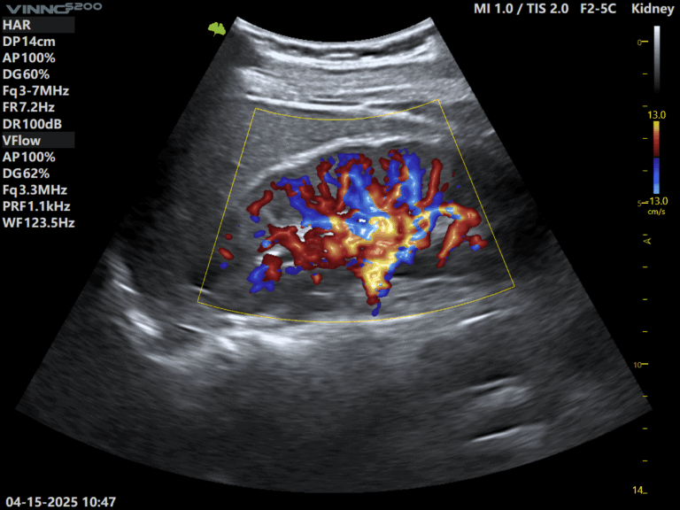ecografe performante ecograf stationar ecograf portabil ecograf cu inteligenta artificiala aparatura medicala moderna echipamente medicale Romania furnizor echipamente medicale magazin aparatura medicala online aparatura pentru clinici medicale dotari cabinete medicale