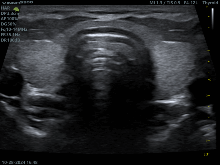 ecografe performante ecograf stationar ecograf portabil ecograf cu inteligenta artificiala aparatura medicala moderna echipamente medicale Romania furnizor echipamente medicale magazin aparatura medicala online aparatura pentru clinici medicale dotari cabinete medicale