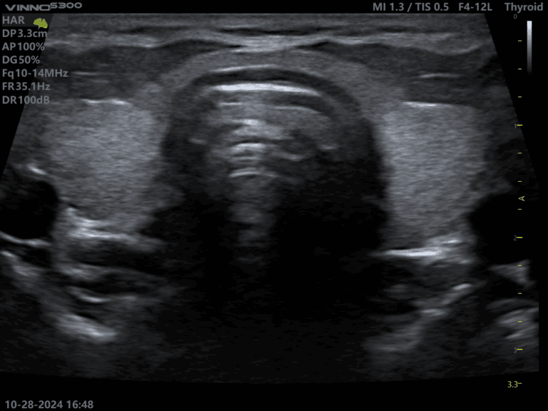 ecografe performante ecograf stationar ecograf portabil ecograf cu inteligenta artificiala aparatura medicala moderna echipamente medicale Romania furnizor echipamente medicale magazin aparatura medicala online aparatura pentru clinici medicale dotari cabinete medicale