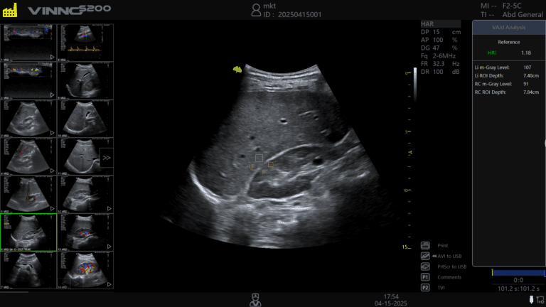 ecografe performante ecograf stationar ecograf portabil ecograf cu inteligenta artificiala aparatura medicala moderna echipamente medicale Romania furnizor echipamente medicale magazin aparatura medicala online aparatura pentru clinici medicale dotari cabinete medicale