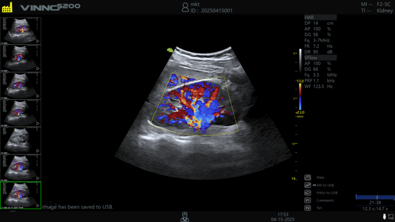 ecografe performante ecograf stationar ecograf portabil ecograf cu inteligenta artificiala aparatura medicala moderna echipamente medicale Romania furnizor echipamente medicale magazin aparatura medicala online aparatura pentru clinici medicale