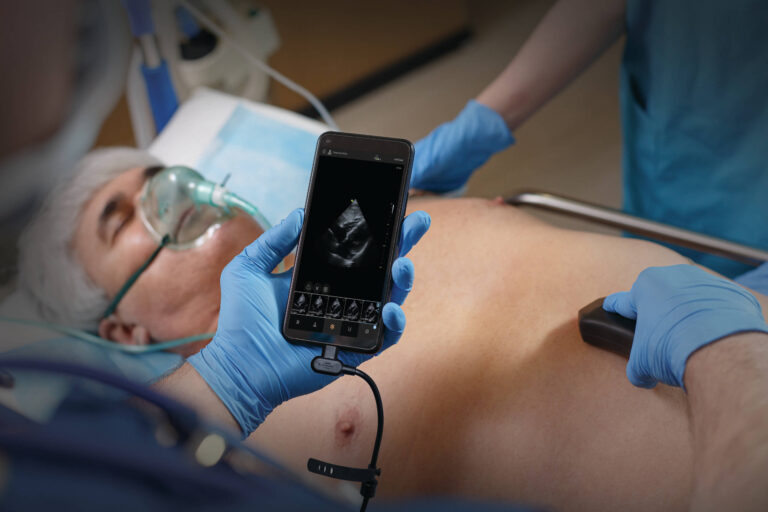 Ecografe portabile si ultraportabile | Numeris Medical