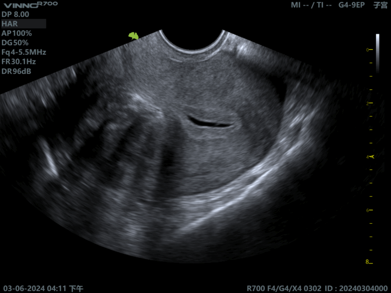 Descoperiți ecograful VINNO R700