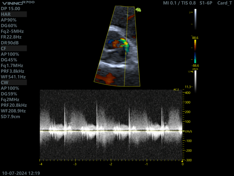 Descoperiți ecograful VINNO R700