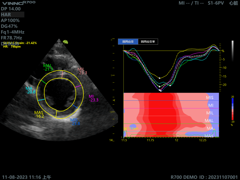 Descoperiți ecograful VINNO R700